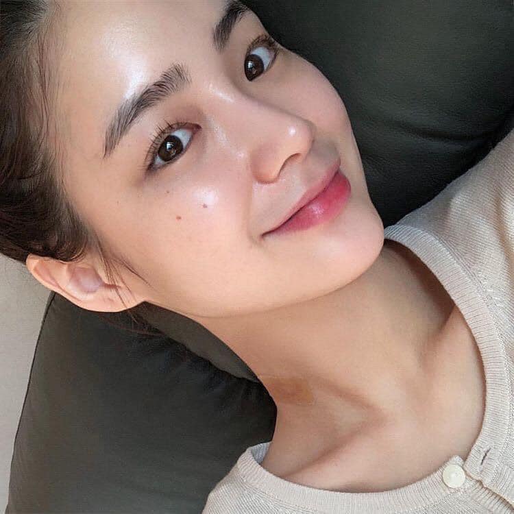 trị mụn 
