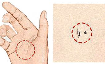 Nhân tướng học tiết lộ 5 vị trí nốt ruồi mang lại giàu sang, phú quý: nốt ruồi ở cuống tai là nốt ruồi "tụ tài" - Blog Marry