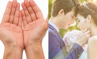 4 vị trí nốt ruồi trên tay là dấu hiệu người có nhân duyên viên mãn - Blog Marry