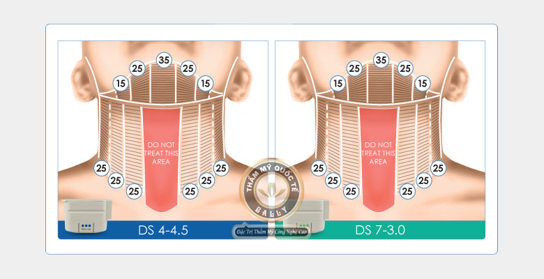 TMV công nghệ cao việt mỹ - Hình 4