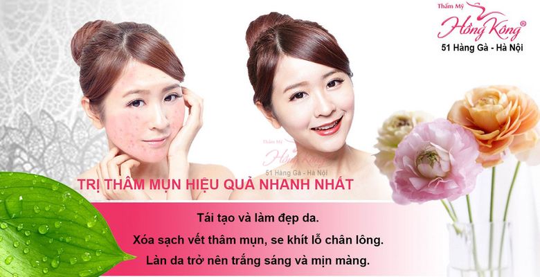 Thẩm mỹ Hồng Kông - Hình 3