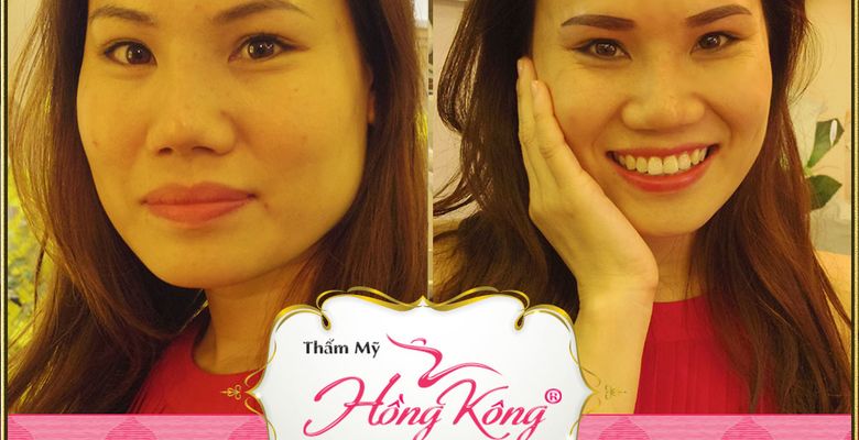 Thẩm mỹ Hồng Kông - Hình 2