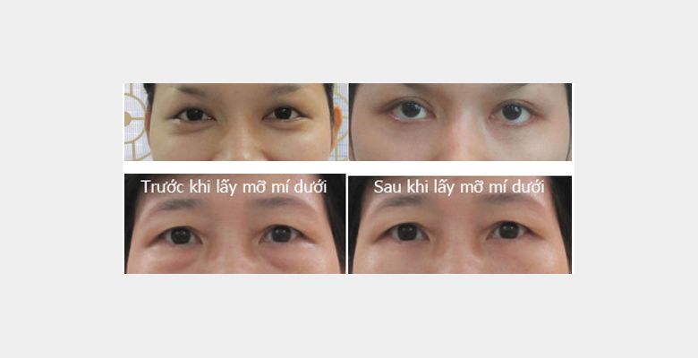 Thẩm Mỹ Viện Y Ngọc _ Bác sĩ Phạm Văn Căn - Quận 1 - Thành phố Hồ Chí Minh - Hình 3