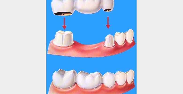 Nha Khoa Nụ Cười Cali - Quận 6 - Thành phố Hồ Chí Minh - Hình 1